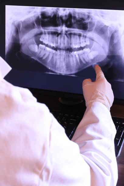 Best Emergency Dental Extractions in Fernandina Beach, FL